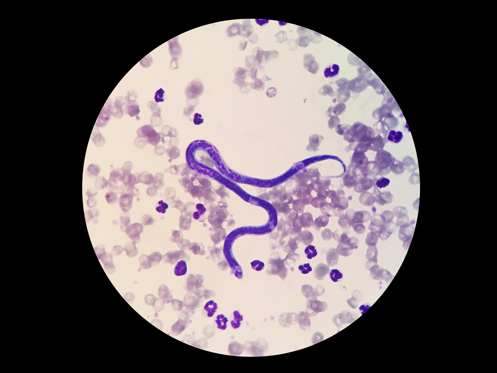 Microscopic blood smear showing microfilariae, used in heartworm diagnosis for dogs
